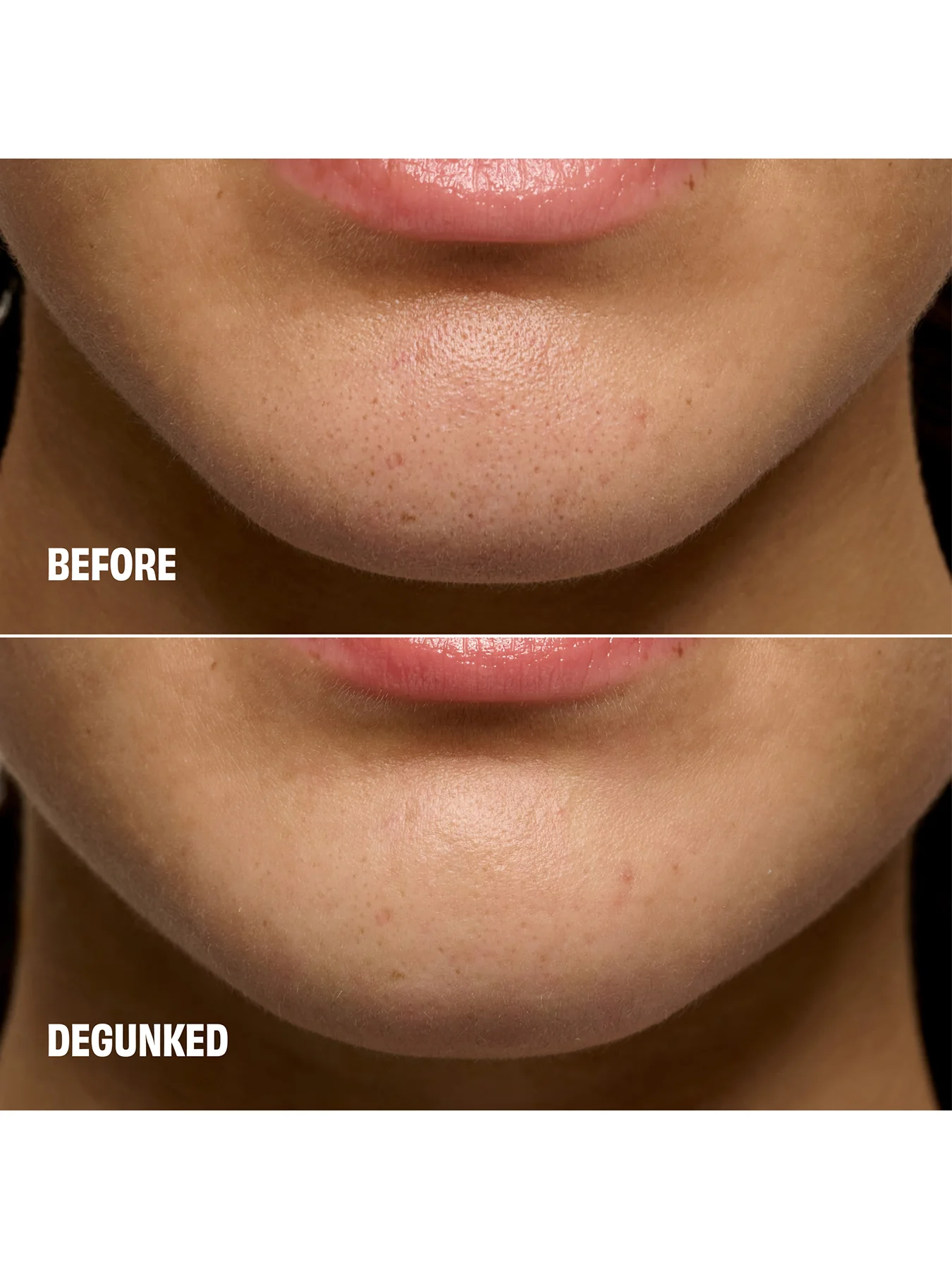 The Porefessional Degunker Blackhead and Pore Cleansing System for Clogged Pores 22ml - Image 4