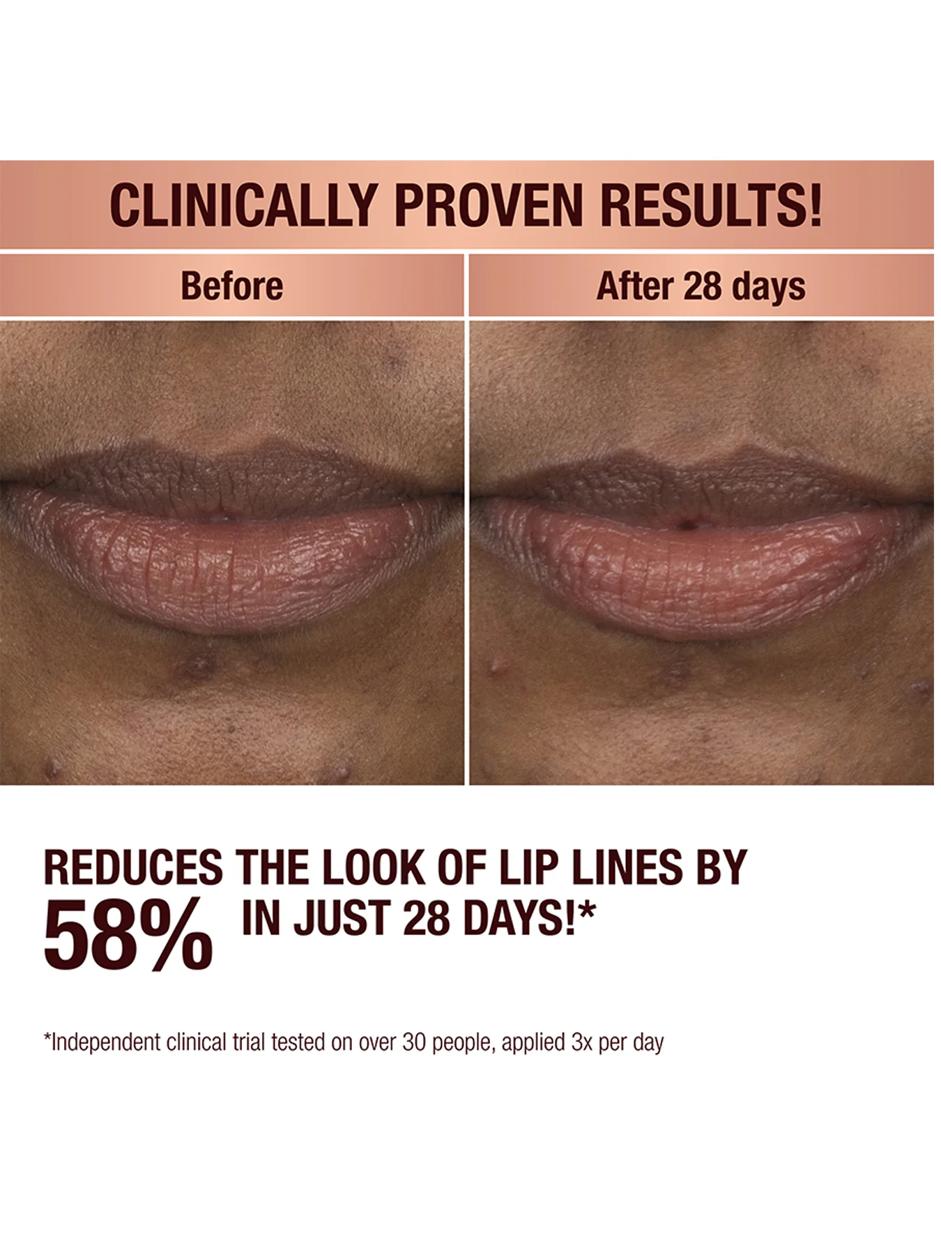 Life Changing Lip Mask - Image 4