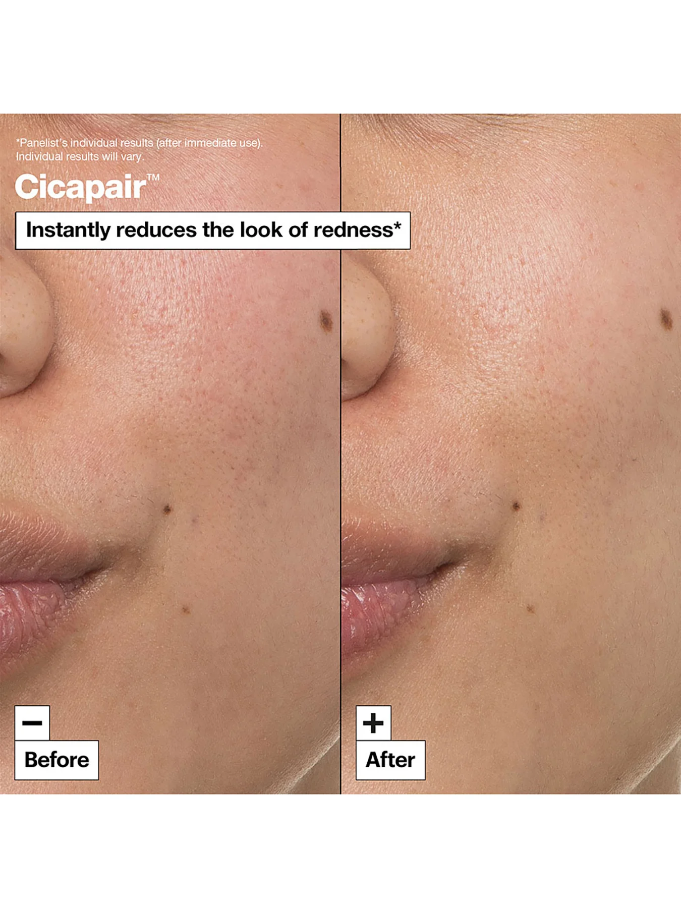 The Cicapair Intensive Soothing Repair Cream 50ml - Image 2
