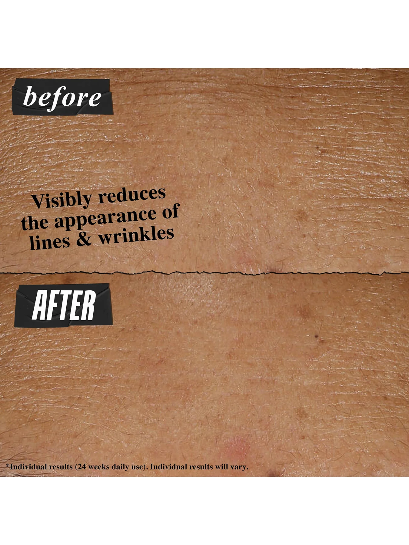 Retinol Skin Renewing Daily Micro-Dose Serum 50ml - Image 3