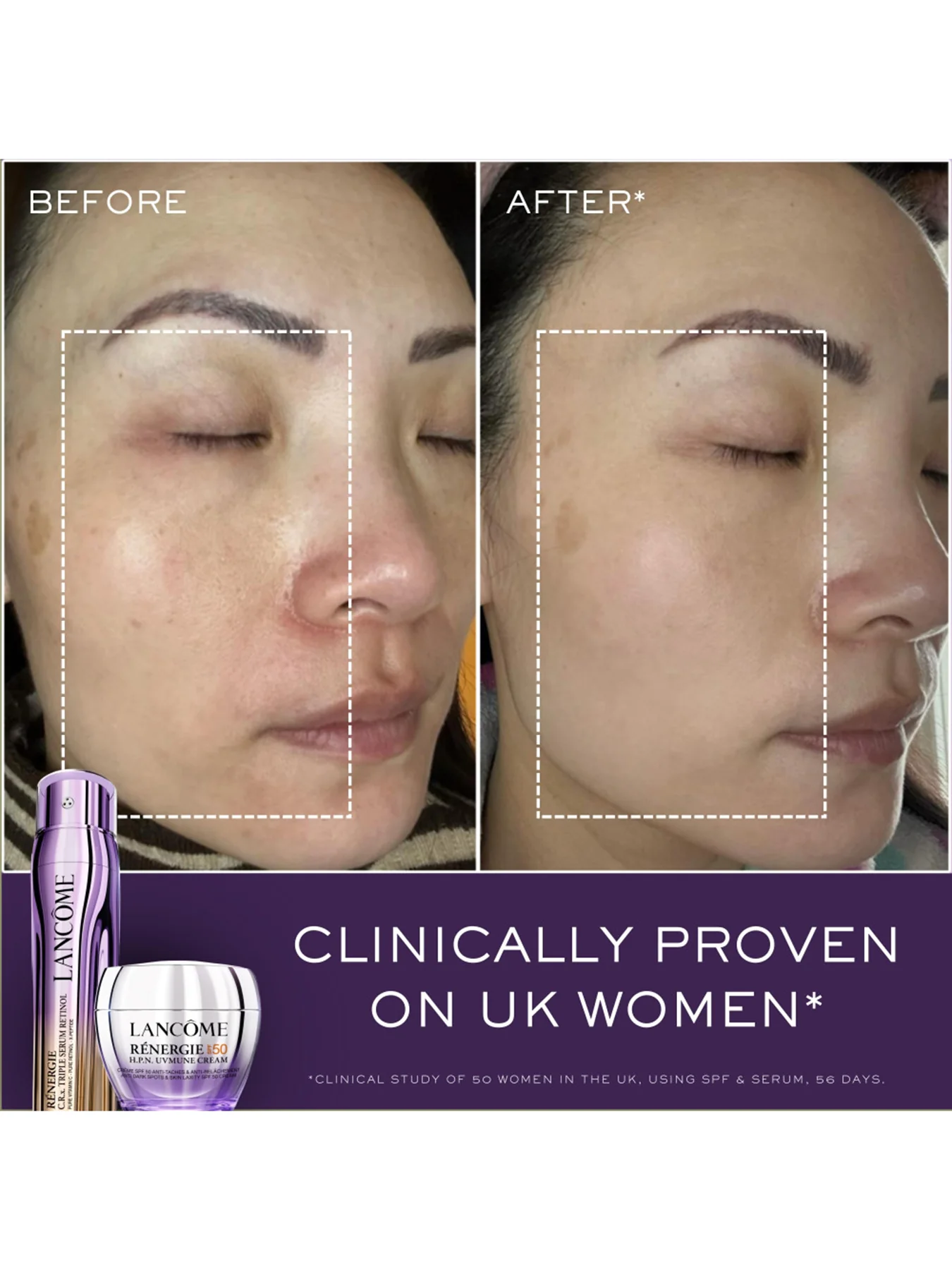 Lancôme Rénergie CRx Triple Serum Gift Set 50ml - Image 3