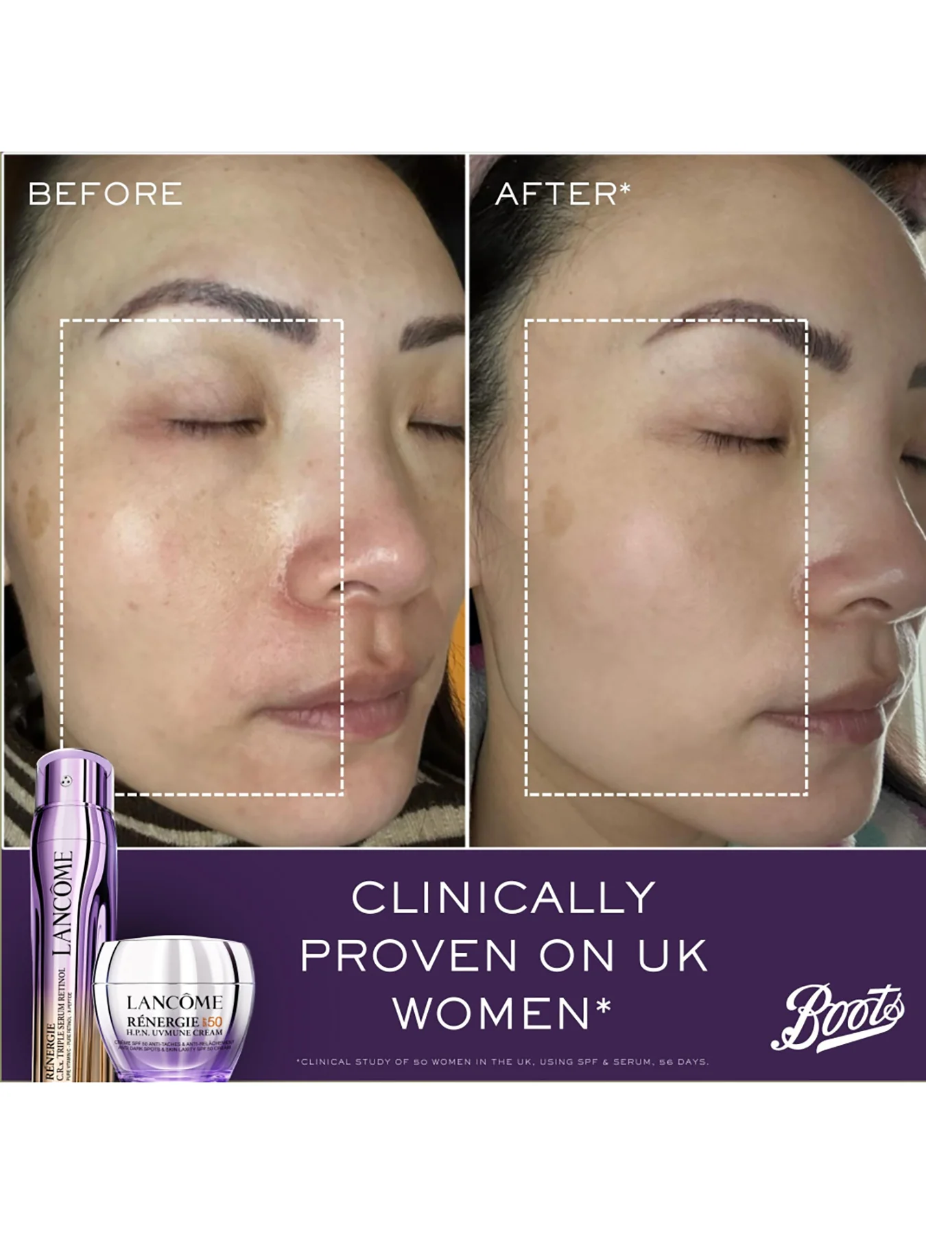 Regenerie Triple Serum Set - Image 4