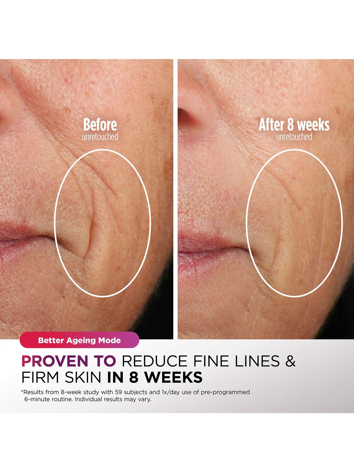 CryoGlow Under Eye Cooling LED Mask - Image 6