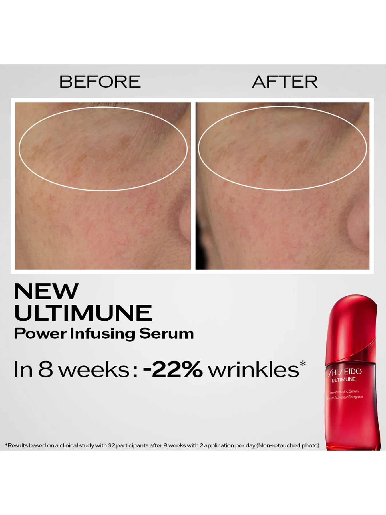 Benefiance Wrinkle Smoothing Starter Kit - Image 4
