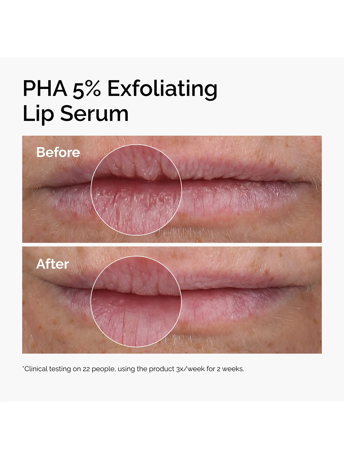 PHA 5% Exfoliating Lip Serum 15ml - Image 2